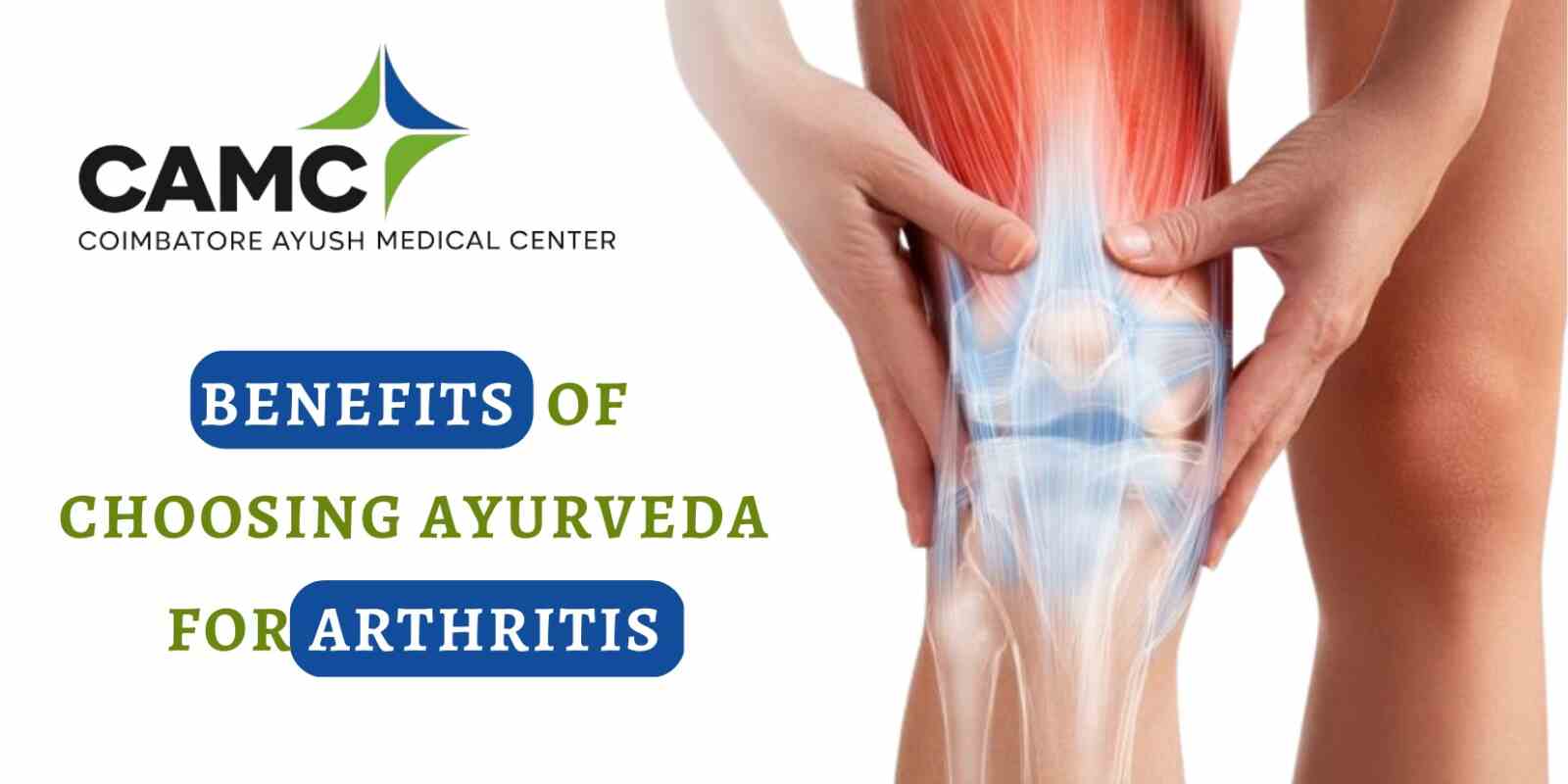 Benefits of Choosing Ayurveda for Osteoarthritis